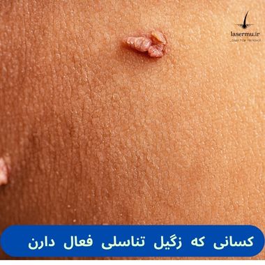 کسانی که زگیل تناسلی دارند