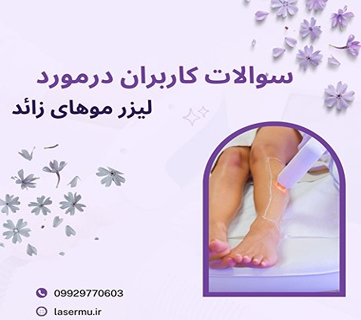 سوالات متداول کاربران در مورد لیزر موهای زائد بدن