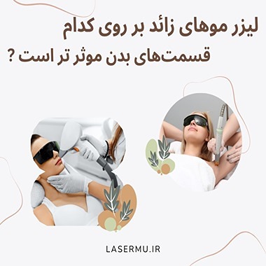 تاثیر لیزر در کدام بخش بدن بیشتر است