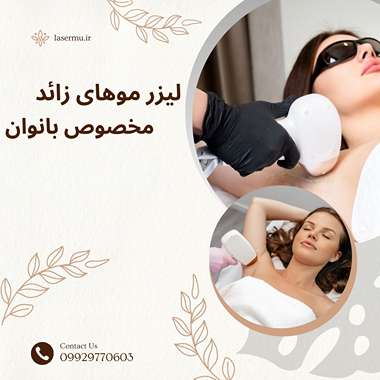 لیزر موهای زائد بانوان