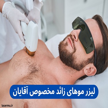 لیزر موهای زائد مخصوص مردان