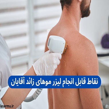 Laser hair removal for men