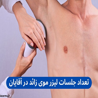 تعداد جلسات لیزر موهای زائد آقایان