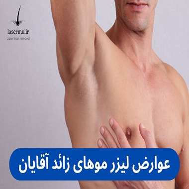 عوارض لیزر موهای زائد برای مردان