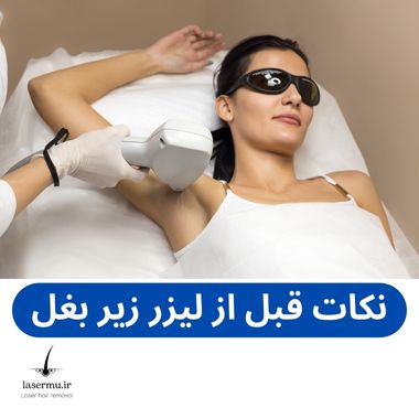 نکات قبل از لیزر موهای زائد زیر بغل