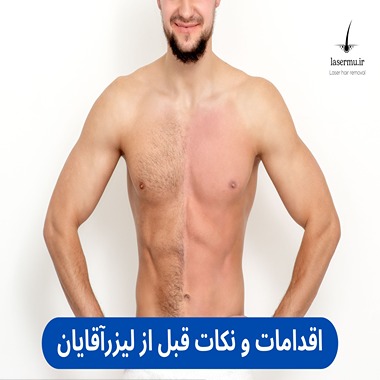 نکات قبل از لیزر موهای زائد چه باید کرد